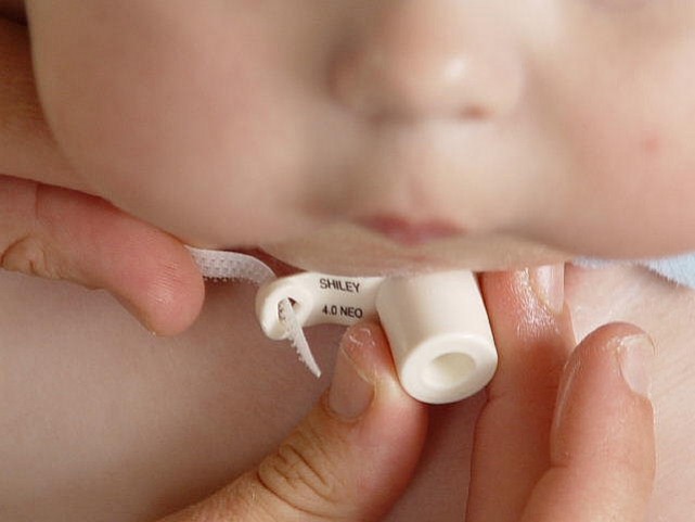 Resized Sample Image