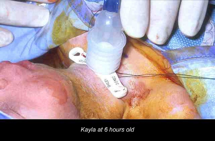 Resized Sample Image